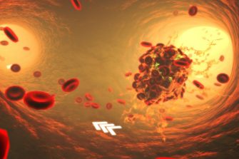 3D MED-i: visualising personalised stroke data