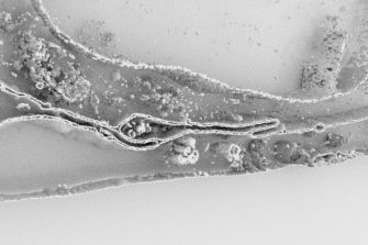 Visualisation solutions for complex data sets