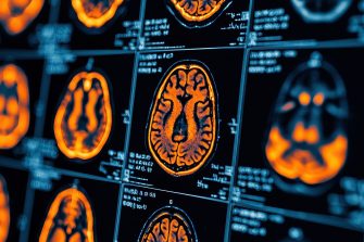Colorful brain scans displayed on an array of medical imaging panels.