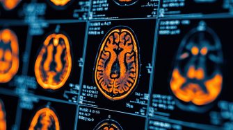 Colorful brain scans displayed on an array of medical imaging panels.