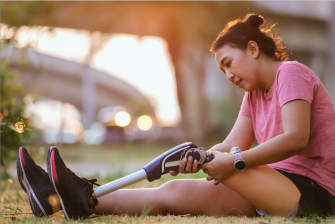 Woman with prosthetic leg