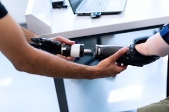 Person holding prosthetic arm