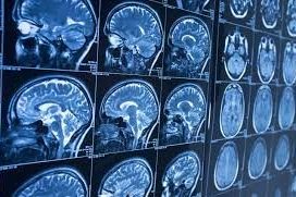 Brain Scan 