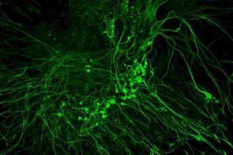 organotypic-explant-of-mouse-auditory-neurons