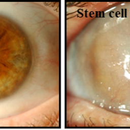 Di Girolamo Group: Ocular Diseases Research