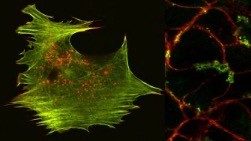 Hardeman/Gunning Group: Cytoskeleton Therapeutics Research Unit (CTRU)