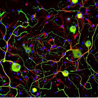 Moalem-Taylor Group: Neuroimmune Pain Research