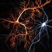 Power Group: Neuroplasticity in Memory & Addiction