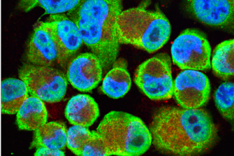 NDRG1 (Green) and ALIX (Red) localization in pancreatic cancer cells