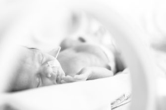 Premature newborn  baby girl in the hospital incubator after c-section in 33 week