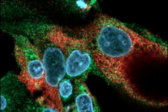 T84 colon carcinoma cells