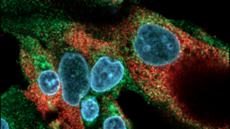 T84 colon carcinoma cells