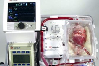 A heart in a box being kept alive by a machine