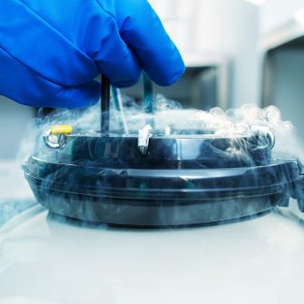 Sample Storage in test-tube laboratory