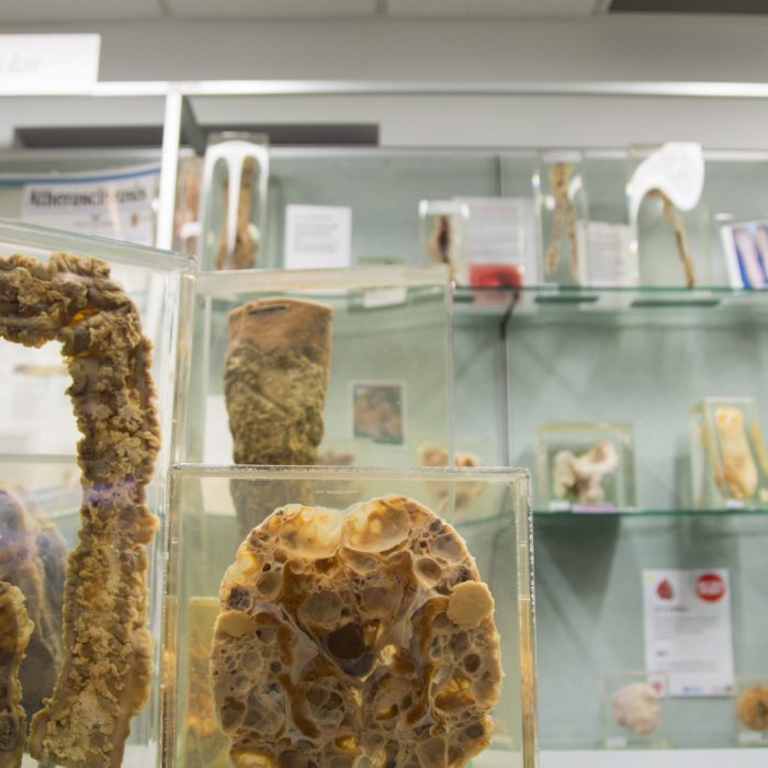 Specimens from the Museum of Human Disease