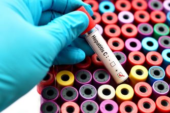 Enhancing scale-up of point-of-care testing for hepatitis C infection