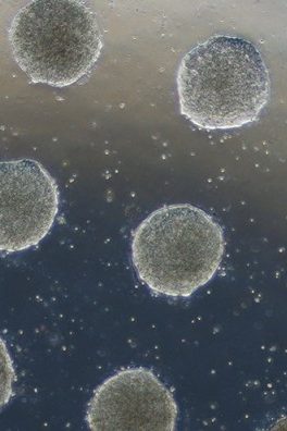 Stem cells confined in a circular shape on a soft gel display characteristics of embryonic development