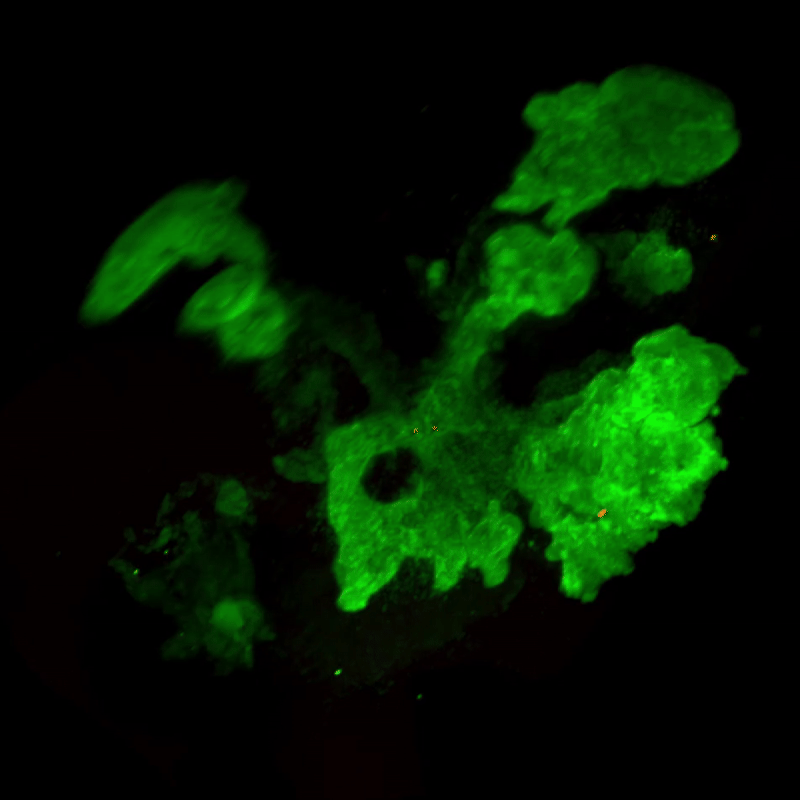 Psc-derived-organoid.motion 