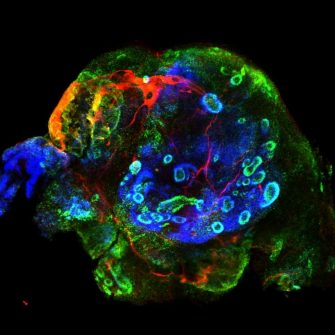 Colourful visualisation of cerebral organoid