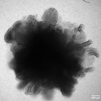 branching-lung-organoids
