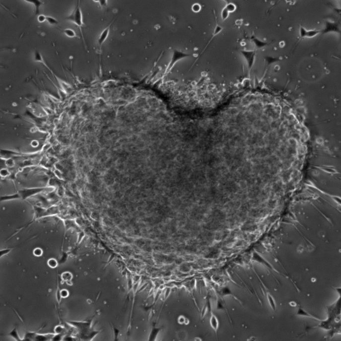 patient-derived-organoid