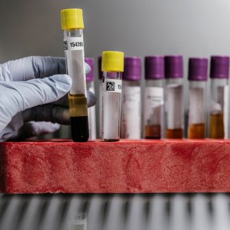 2024-12 Incidental photos of biospecimen samples in test tubes and slides