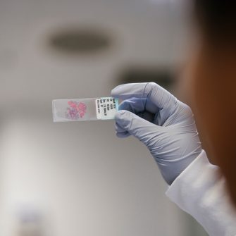 2024-12 Incidental photos of biospecimen samples in test tubes and slides