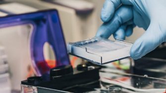 Agar Jelly plate banner