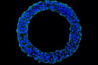 Blue circle comprised of small dots