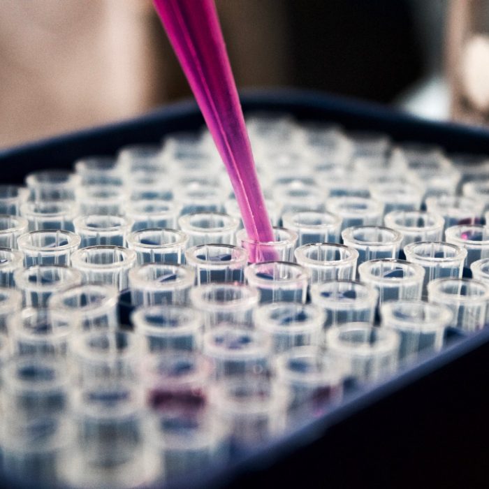 The UNSW Salivary Bioscience Research Centre (SBRC) within the School of Psychology provides researchers and industry with access to high-quality saliva testing services. 