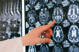 NHMRC Centre of Research Excellence in Brain Recovery