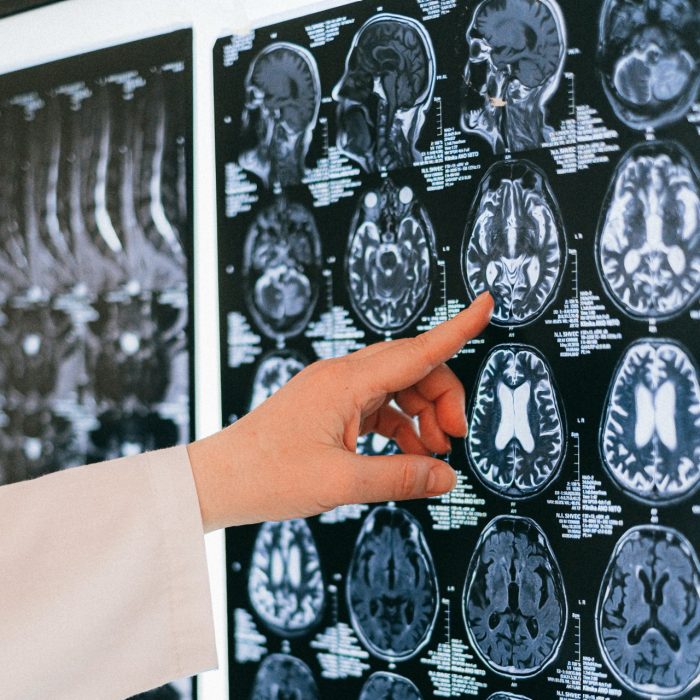 NHMRC Centre of Research Excellence in Brain Recovery