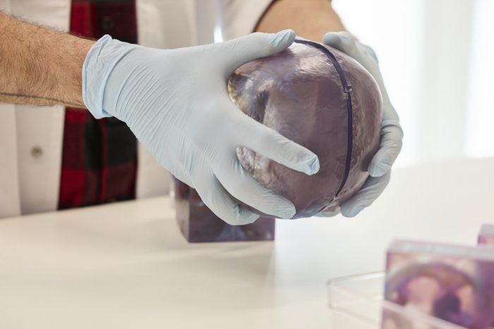 Integrated-Accute-Services