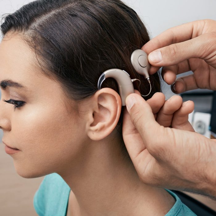 A woman has part of the cochlear implant technolgy attached behind her ear