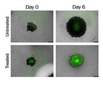 Effect of a high-potency drug on a co-culture model of pancreatic cancer cells and fibroblasts, demonstrating inhibition of metabolic cross-talk within the tumor microenvironment.