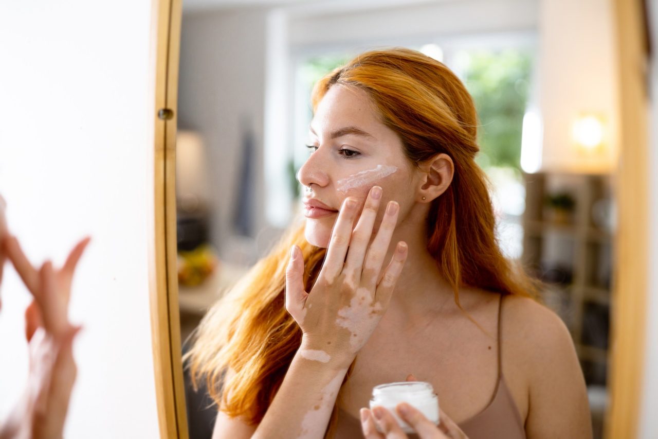 Young woman with vitiligo applying skin cream in mirror at home