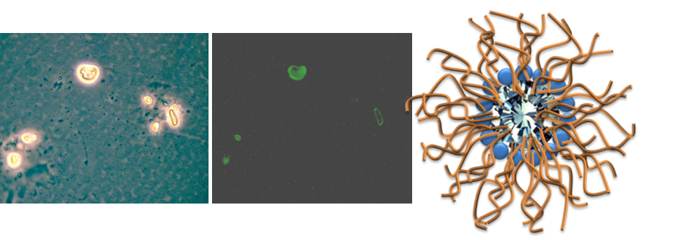 Light microscope (left) and fluorescent microscope (right) images of tumour cells after being incubated with nanodiamonds coated with polymers.