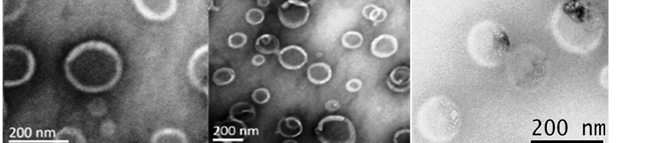 TEM images of hollow nanoparticles (left and middle) synthesized via inverse miniemulsion periphery polymerization (RAFT) of MMA and EGDMA. Right: TEM of hollow spheres with protein located in the core